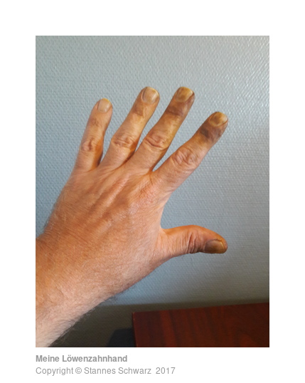 Meine Löwenzahnhand